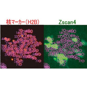 理研、ES細胞がテロメア長を維持することで老化を回避する仕組みを解明