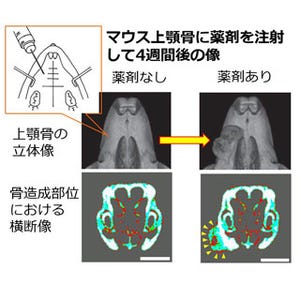 東京医科歯科大、薬剤の注射で顎の骨を造成することに成功