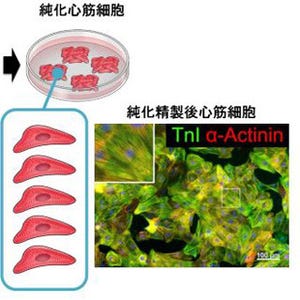 慶大、ヒトiPS細胞から高純度な心筋細胞の作製に成功 - 特殊な培養液を利用