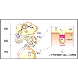 着床不全の母体側の原因はSox17遺伝子発現量の低下 - 東京医科歯科大など