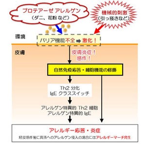 アレルゲンに触れた状態で皮膚を掻くとアレルギーは重症化する - 順天堂大