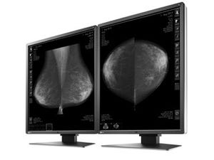 EIZO、乳房トモシンセシスやマンモグラフィ表示向け5M画素医用モニタを発売