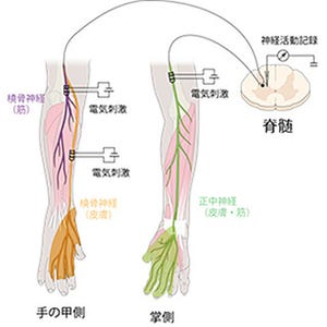 NCNP、"自分でくすぐってもくすぐったくない"神経機構を解明