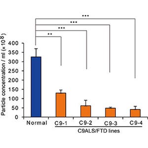 NCNP、ALSや前頭側頭型認知症の病態に関わる分子機構を発見