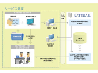 NTTデータアイなど2社、医療用クラウド型「脳波解析システム NATESAS」
