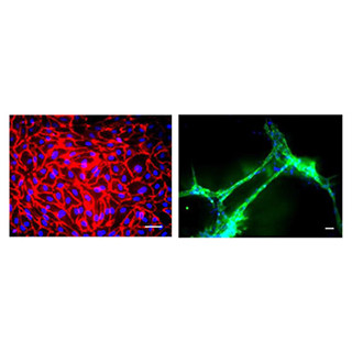 京大CiRA、ヒトiPS細胞から高効率に血管内皮細胞を作る方法を確立
