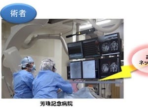 金沢大、4K映像伝送による血管内治療における遠隔医療指導の実証実験を実施