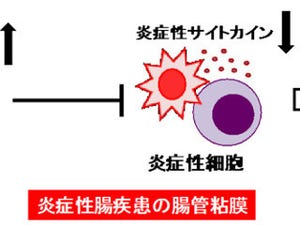 富山大学、炎症性腸疾患に対する新規治療薬の可能性を発見