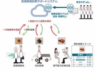 KCCSと筑波大学がAI活用した画像認識による皮膚疾患診断サポートシステム