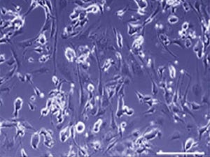 iPS細胞で、がん細胞が増殖する環境を作る原因を発見 - 岡山大