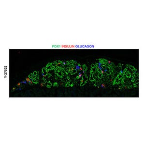 膵芽細胞への分化を制御するメカニズムに細胞骨格関連分子が関与 - 京大
