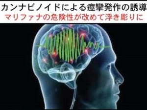 マリファナはやはり危険だった - 筑波大が大麻の有害性を実証