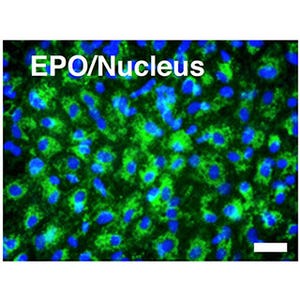 京大CiRA、ヒトiPS/ES細胞からエリスロポエチン産生細胞を作製