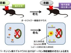 オートファジーの破綻がパーキンソン病の原因となる