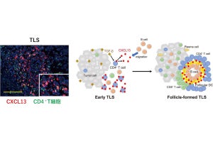 京大、卵巣がんの免疫応答に関わる三次リンパ様構造の形成機構の一端などを解明