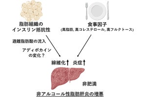 神戸大、脂肪肝の重症型「非アルコール性脂肪肝炎」の原因を解明
