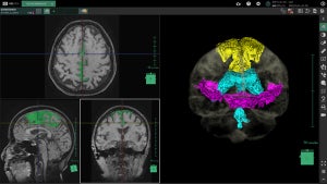 富士フイルムら、脳脊髄液腔の各領域を抽出するAI技術を共同開発