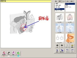 ワコム、医療機関向けソリューション「電子カルテ用シェーマ画像集」発売