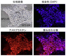 東北大ら 歯の再生につながるips細胞から エナメル芽細胞 の誘導に成功 Tech