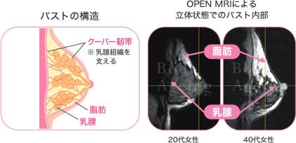 夏のノーブラにバストが悲鳴 体に合ったブラ選びは美しいバストの第一歩 マイナビニュース