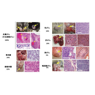 九大、タンパク質MOB1が皮膚外毛根鞘がんの原因遺伝子であることを特定 