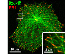 理研 微小管 の先端に新しい構造領域とその機能を発見 Tech