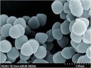 スギ花粉飛散量、関東は最大7倍との予測も。症状緩和に有効な「フェカリス菌」とは?