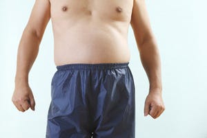 医療関係企業、社員が落とした体重68kgの総カロリーを金額換算して寄付!