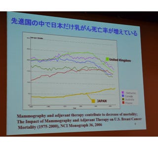 15人にひとりは乳がんに 発症リスクを約1 3にできる生活習慣とは マイナビニュース