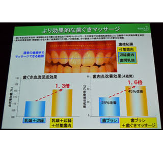 がんのリスクも高める歯周病、歯ブラシ＋1～2分でできる効果的な対策は?