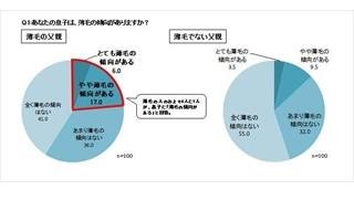 薄毛の人の息子は4人に1人が薄毛 -うち4割は薄毛のタイプまで似ていた!