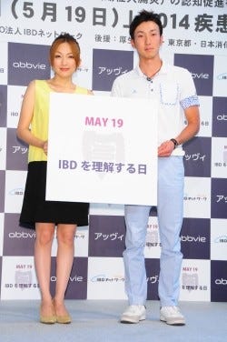 山田まりや やんちゃな長男に 前歯を2本折られちゃいました マイナビニュース