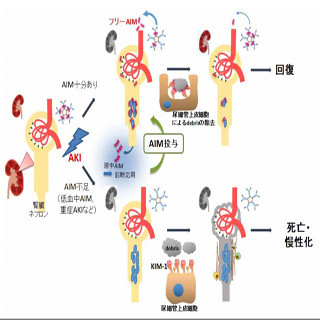 血液中のタンパク質が急性腎不全治療に役立つことが示唆 - 東大などが発表