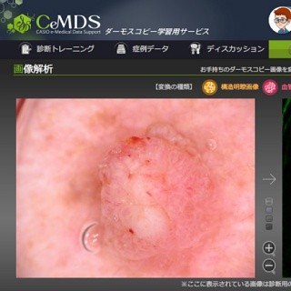 カシオ、医師向け学習用クラウドサービスのコンテンツを拡充