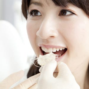 歯列矯正のメリットと矯正前・矯正中の注意点