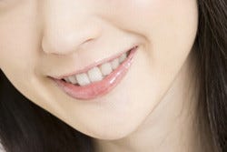 口角炎は病気のサイン 口の端が切れる原因やヘルペスとの違いを解説 1 マイナビニュース
