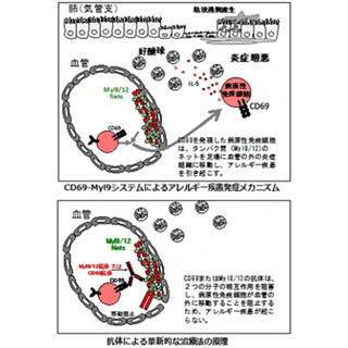 喘息など重症アレルギー疾患発症のカギとなる「タンパク質」を発見