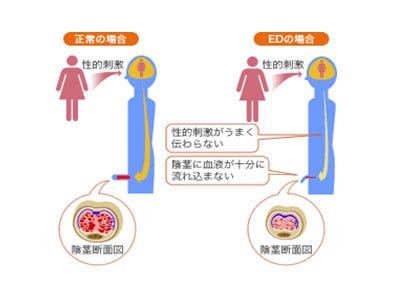 100以上 中折れ 意味