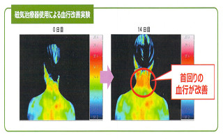 花粉によるアレルギー症状が肩こり・腰痛につながる? 原因と解消法を知る