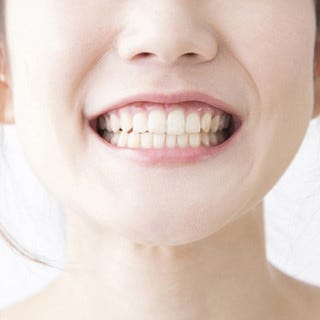 外国人は 日本人の歯並びは悪い と思っているのか マイナビニュース