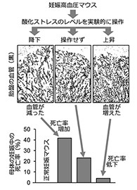 東北大学 酸化ストレスが妊娠高血圧症候群の病態を改善することを発見 Tech