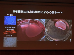 Ips細胞由来心筋シート はダーウィンの海を越えられるのか 第一三共 阪大発ベンチャー企業に出資 共同研究を開始 Tech