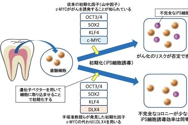 岐阜大ら ガン誘発リスクを低減できるips細胞誘導方法の米国特許を取得 Tech