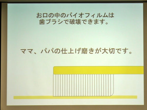 歯の将来は乳歯ケアにかかっている!? 小児歯科医に聞く乳歯のフッ素ケア