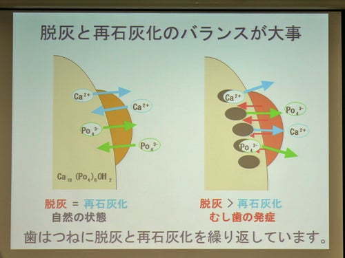 歯の将来は乳歯ケアにかかっている!? 小児歯科医に聞く乳歯のフッ素ケア