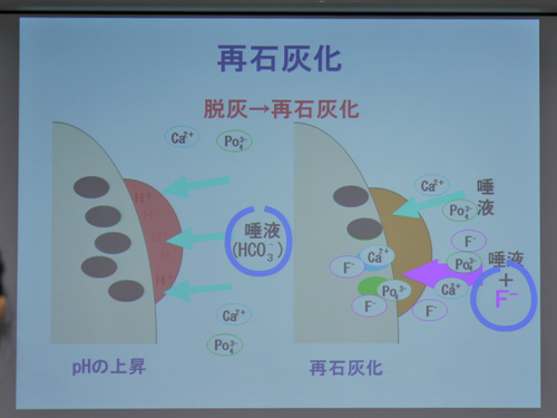 歯の将来は乳歯ケアにかかっている!? 小児歯科医に聞く乳歯のフッ素ケア