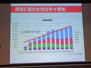 女性の薄毛の原因と対策を専門医が解説