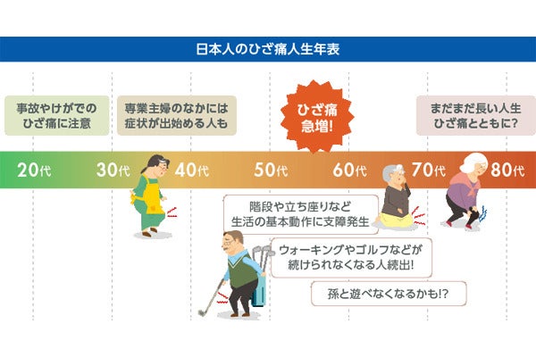 ひざの痛みが出てきた年齢は 職業別で出始めのタイミングに差 マイナビニュース