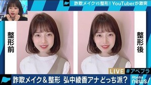 弘中綾香アナ、整形シミュレーション画像に歓喜「私こんな伸びしろあるんだ」