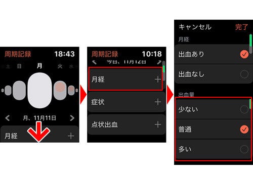 点 状 出血 と は